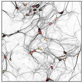 200728-Freund-in-Brain