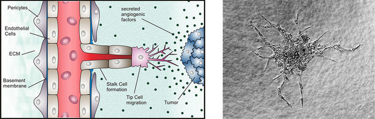 Angiogenesis