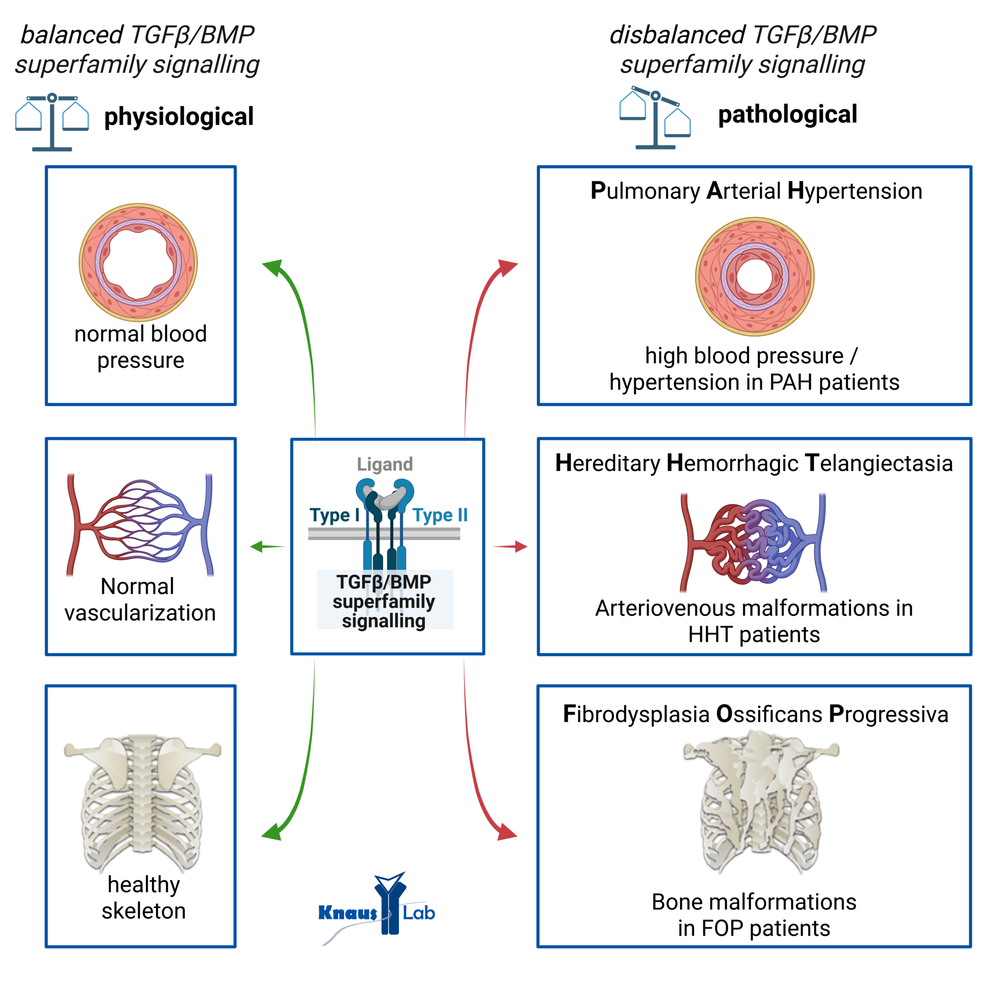 TGF-β/BMP signaling in rare diseases