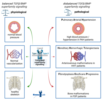 TGF-β/BMP signaling in rare diseases