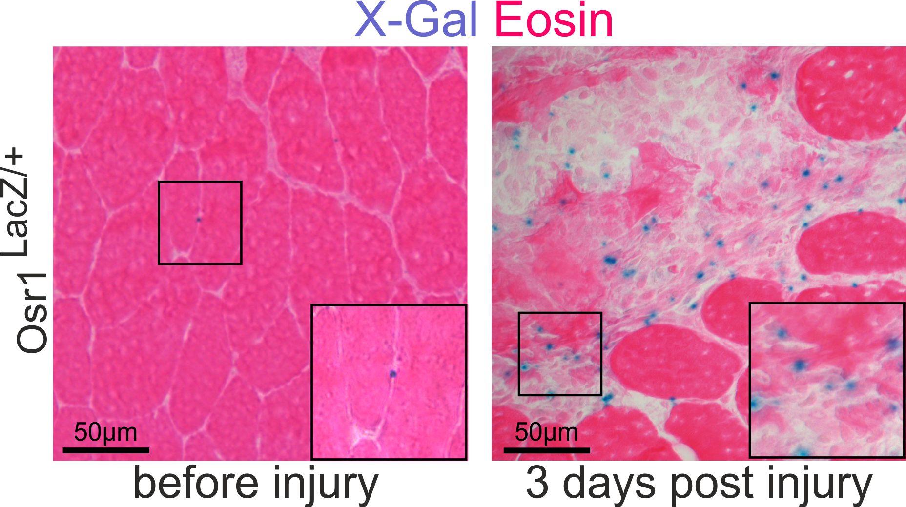 Re-expression of Osr1 in injured muscle shown by LacZ staining from an Osr1-LacZ allele