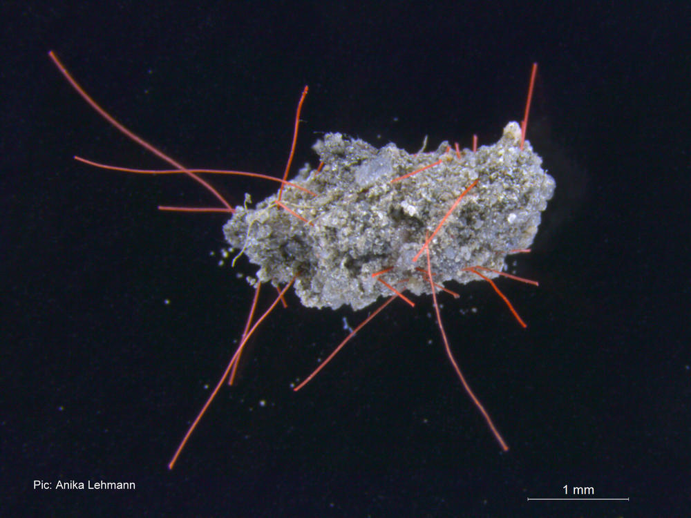 Bodenaggregat-mit-Mikroplastik-Fasern